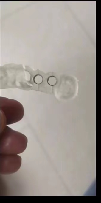 Resin Dental 3D Printer Planti - 3D Printing Uv Resin ulasan dan harga